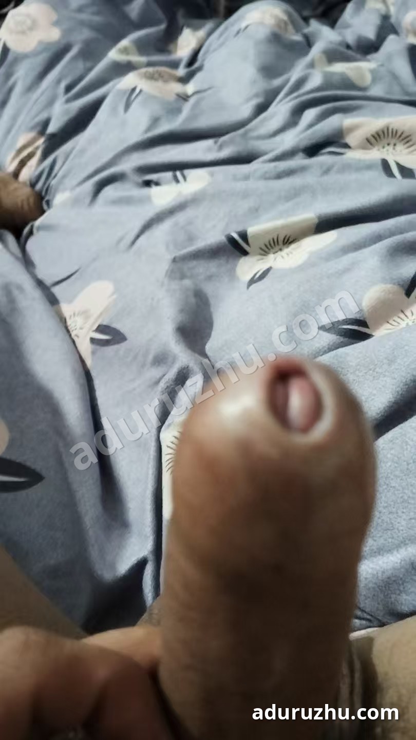 包茎的情况：龟头无法露出
