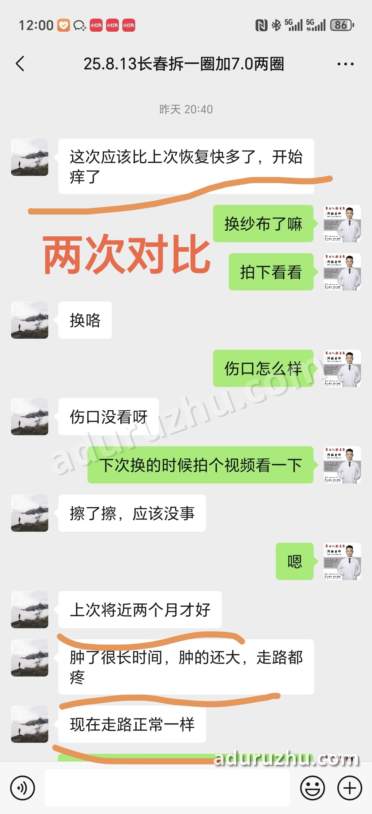 同一个人:这次在阿杜老师这里做,走路正常