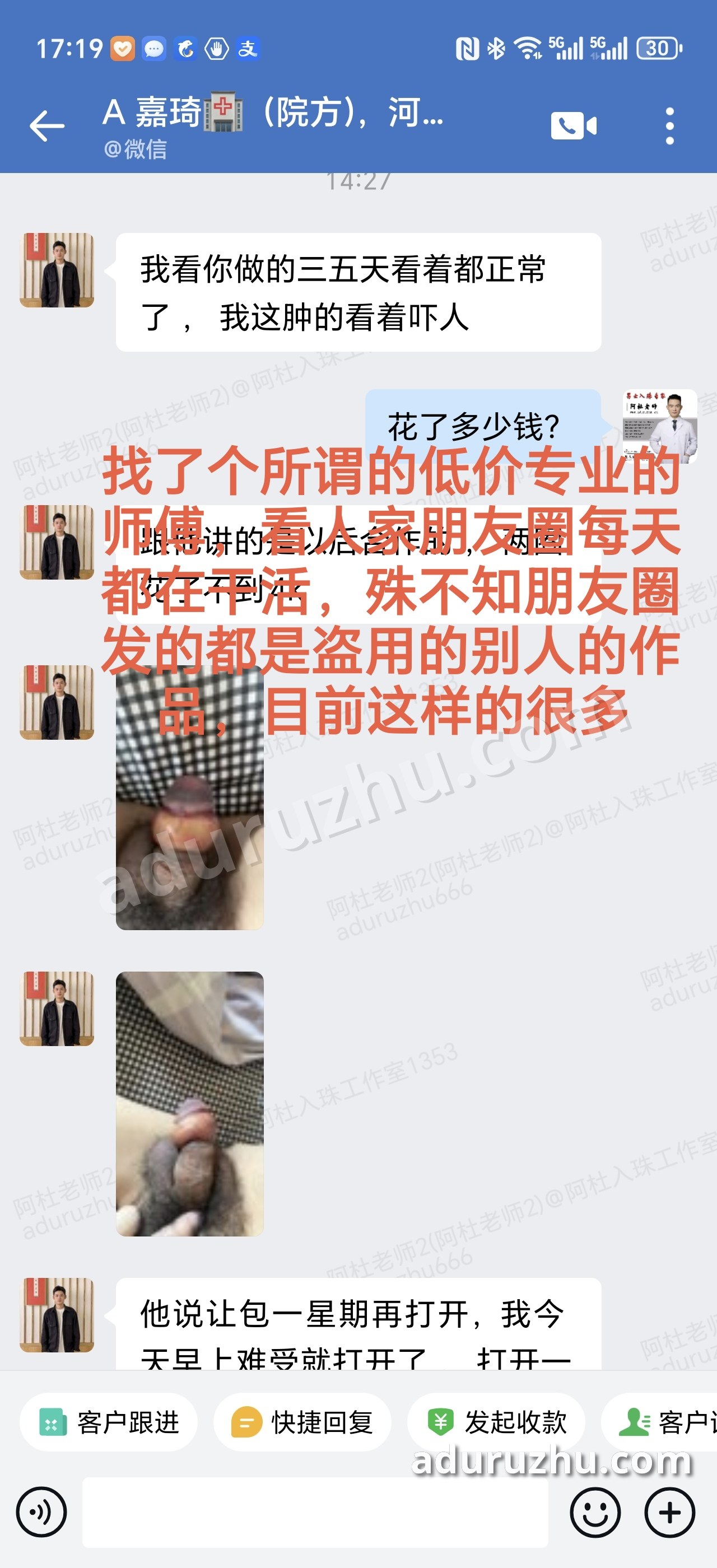 私聊:找了个所谓低价的"专业"师傅,做完肿得吓人