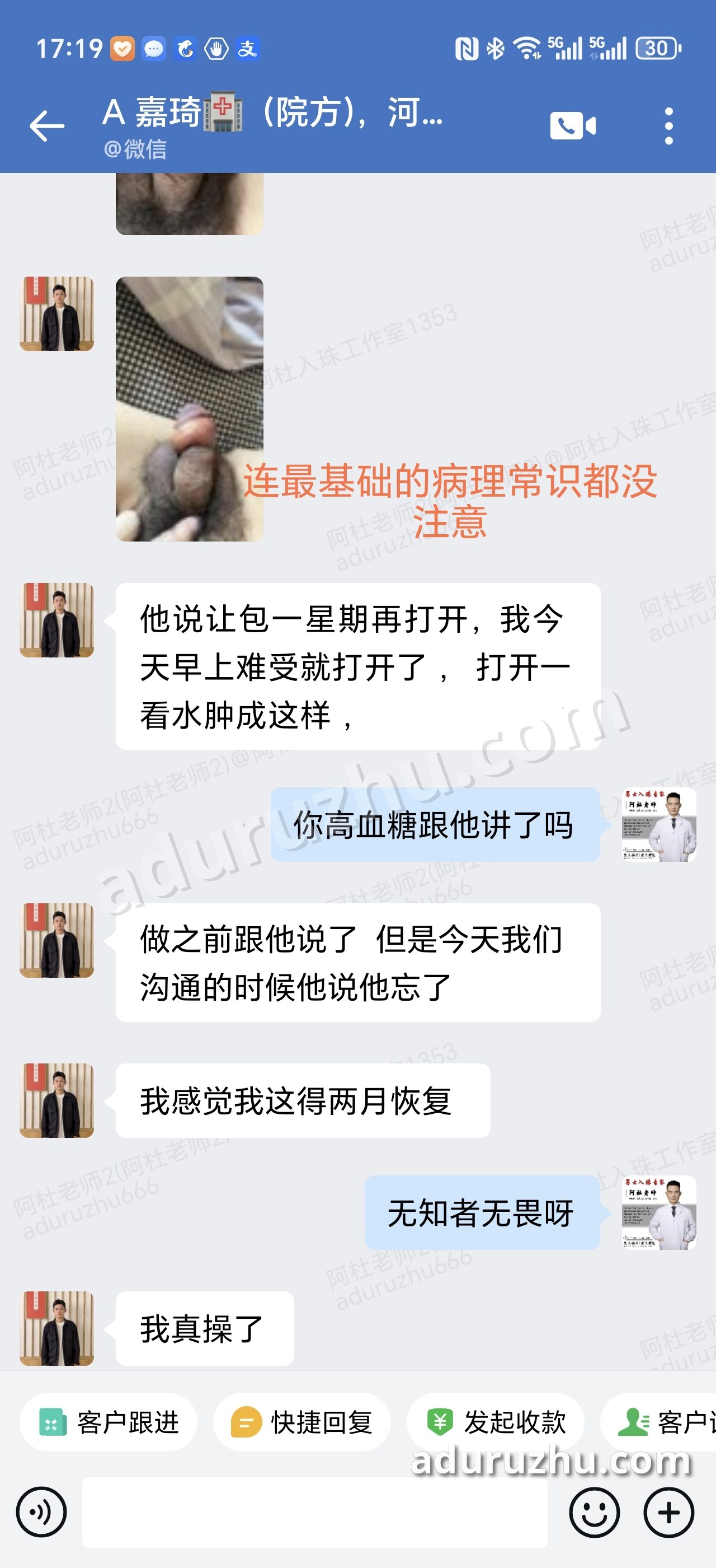 包了一星期打开,水肿成这样;有高血糖,做之前说了,对方说忘了