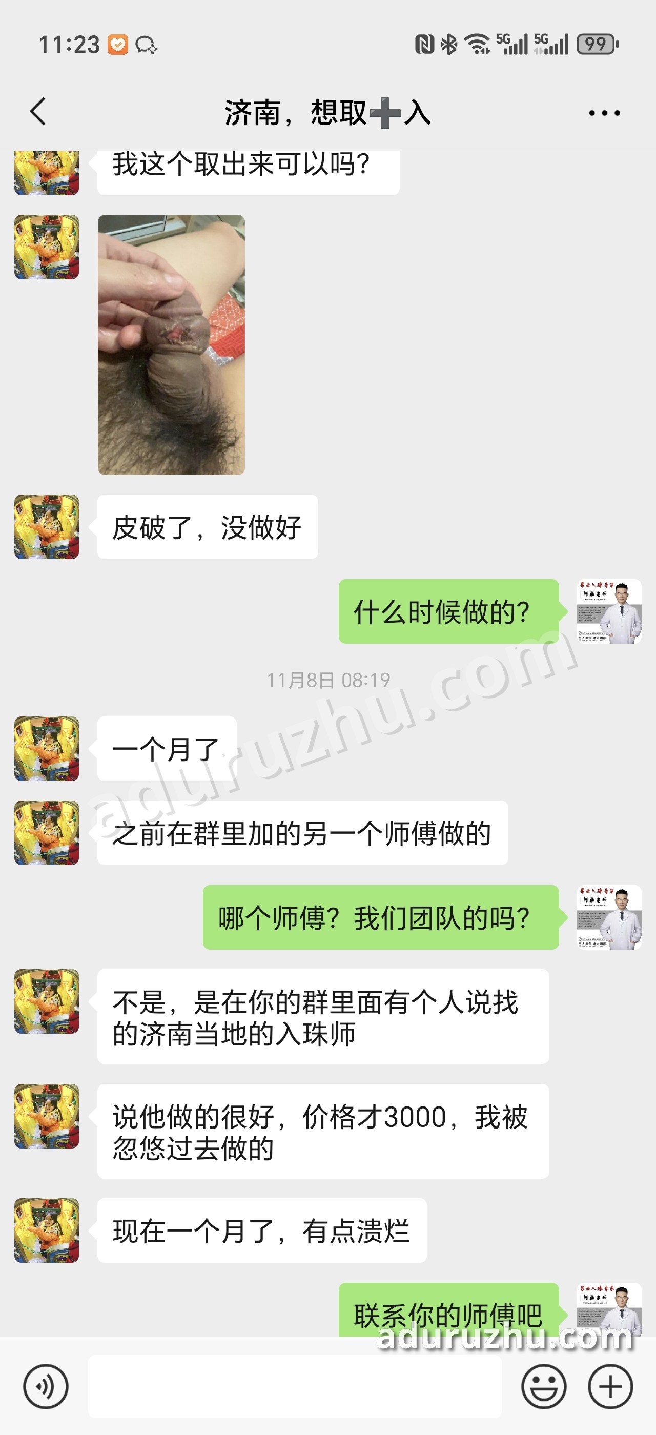 被群里的人"推荐"去济南当地做,一个月后开始溃烂