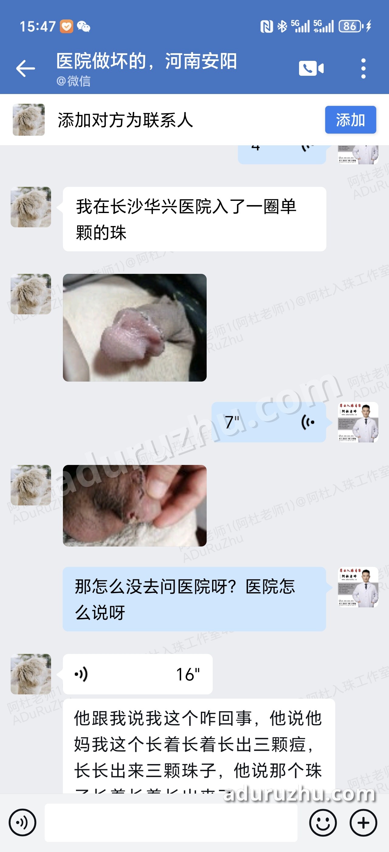 在医院做的入珠,伤口紧挨着珠子