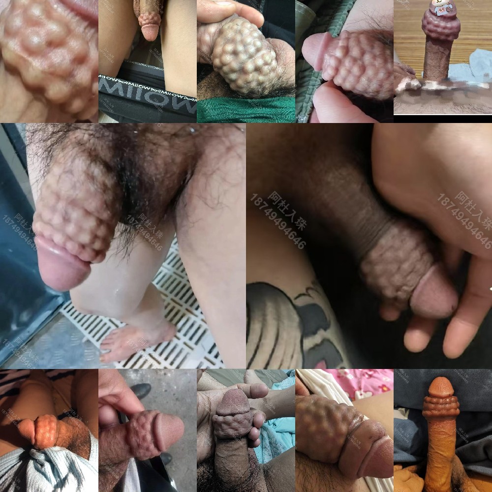 入珠效果：多圈（图片）